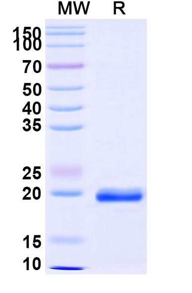 Anti-Castor bean Ricin Recombinant Nanobody (SAA1148) - SDS-PAGE