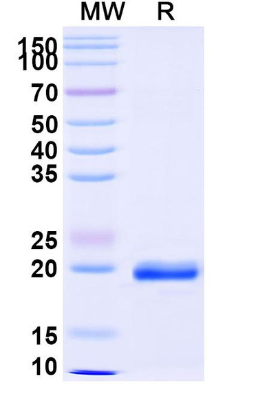 Anti-Castor bean Ricin Recombinant Nanobody (SAA1148) - SDS-PAGE