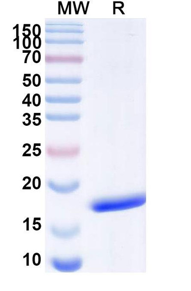 Anti-European white birch Bet v 1/Allergen Bet v I-A Recombinant Nanobody (SAA1357) - SDS-PAGE