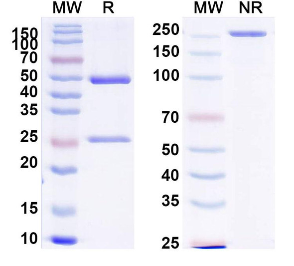 Anti-Human EDB/EDB-FN Recombinant Monoclonal Antibody (SAA1375) - SDS-PAGE