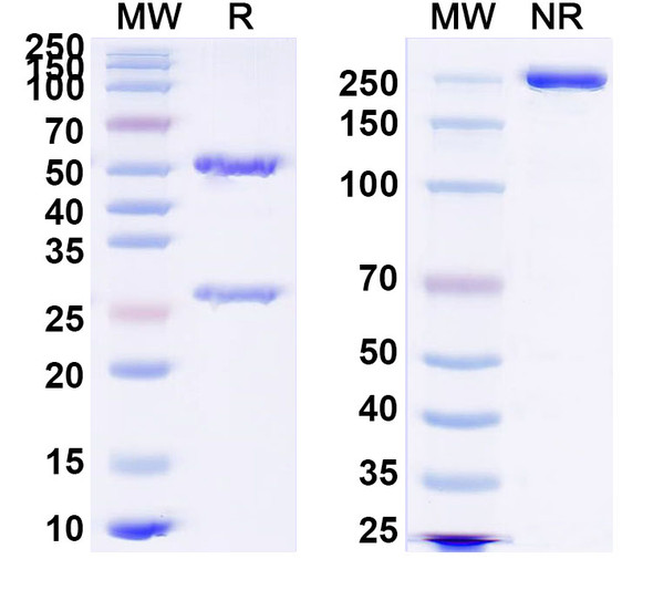 Anti-Human S100A9 Recombinant Monoclonal Antibody (6B4) - SDS-PAGE