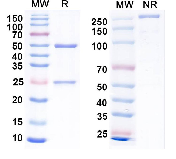 Anti-Pan HBV S/L-HBsAg/L glycoprotein Recombinant Monoclonal Antibody (KR127) - SDS-PAGE