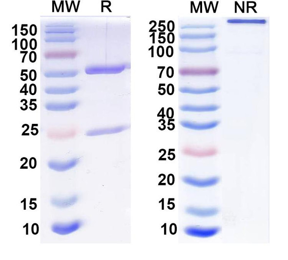 Anti-HBV S/L-HBsAg/L glycoprotein Recombinant Monoclonal Antibody (G10) - SDS-PAGE