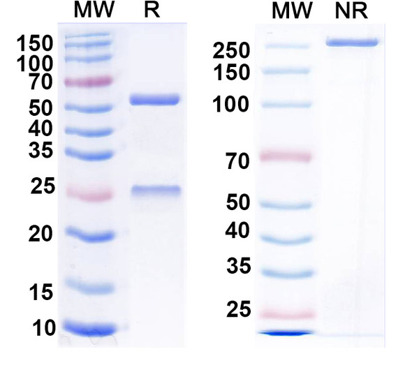 Anti-HBV-D HBcAg/HBeAg Recombinant Monoclonal Antibody (E13#) - SDS-PAGE