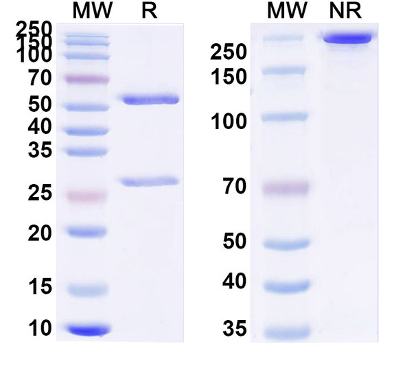 Anti-Influenza A virus Neuraminidase/NA protein Recombinant Monoclonal Antibody (NC41) - SDS-PAGE