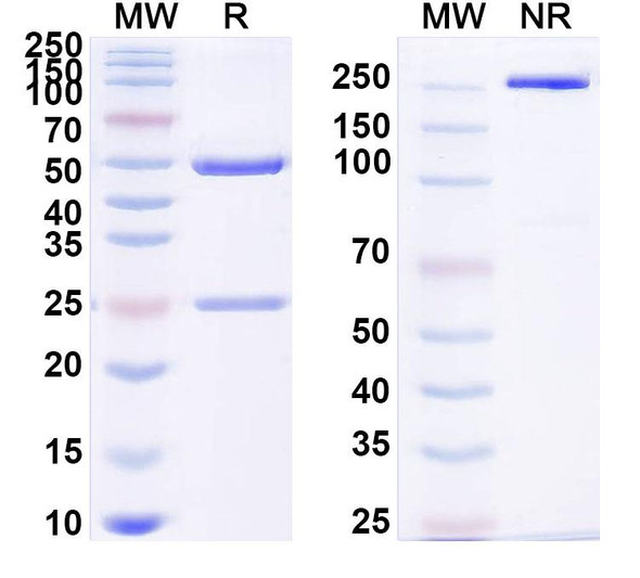 Anti-MBG/Marinobufagenin Recombinant Monoclonal Antibody (SAA1428) - SDS-PAGE