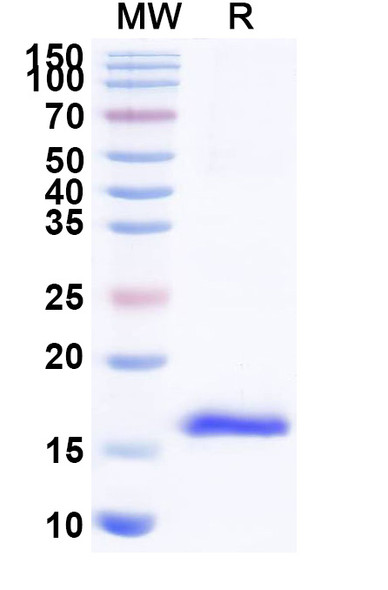 Anti-HIV-1 nef/F-protein protein Recombinant Nanobody (SAA1423) - SDS-PAGE