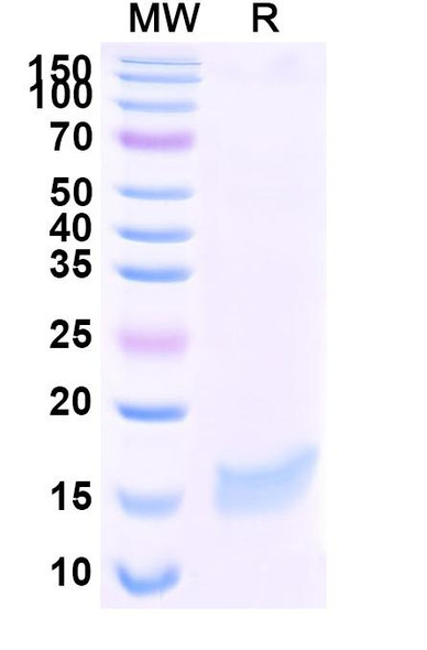 Anti-Influenza A virus RNA polymerase complex Recombinant Nanobody (SAA1427) - SDS-PAGE