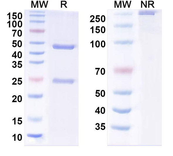 Anti-MERS-CoV S2 Protein Recombinant Monoclonal Antibody (MERS-27) - SDS-PAGE