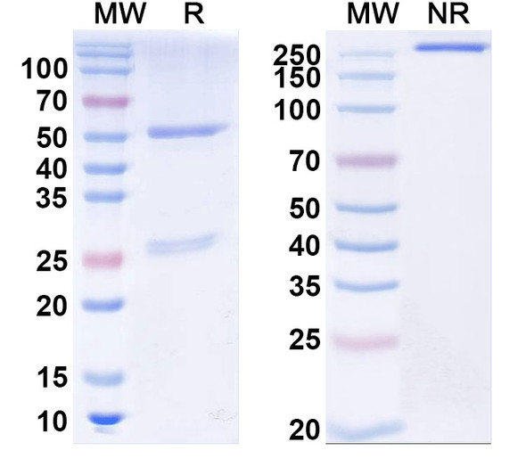 Anti-Influenza A virus Neuraminidase/NA Recombinant Monoclonal Antibody (Mem5) - SDS-PAGE