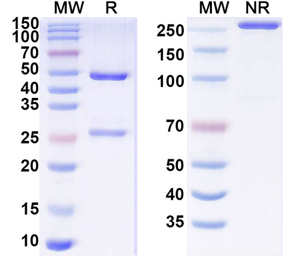 Anti-Human MYH2 Recombinant Monoclonal Antibody (SF9) - SDS-PAGE