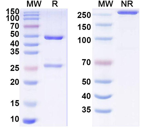 Anti-Human MYH2 Recombinant Monoclonal Antibody (SF9) - SDS-PAGE