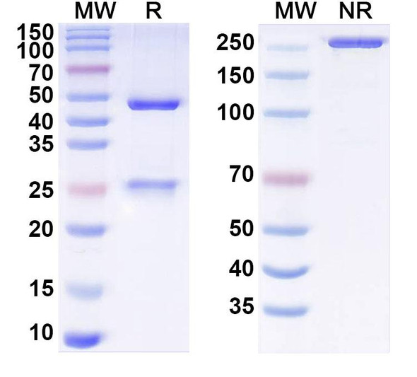 Anti-Human MYH9 Recombinant Monoclonal Antibody (SAA1446) - SDS-PAGE
