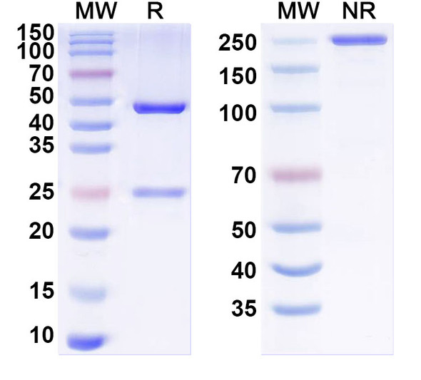 Anti-Human GIPR/GIP-R Recombinant Monoclonal Antibody (SAA1449) - SDS-PAGE