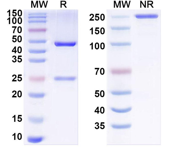 Anti-Human GIPR/GIP-R Recombinant Monoclonal Antibody (SAA1449) - SDS-PAGE
