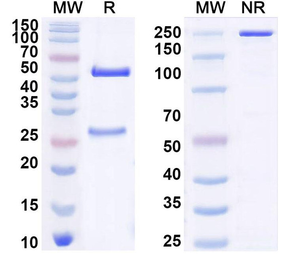 Anti-Human FABP4/aP2 Recombinant Monoclonal Antibody (HA3) - SDS-PAGE
