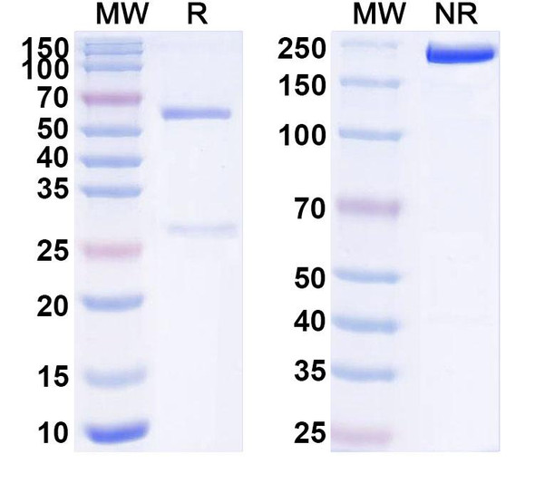 Anti-Human DLG4/PSD95 Recombinant Monoclonal Antibody (K28/43) - SDS-PAGE