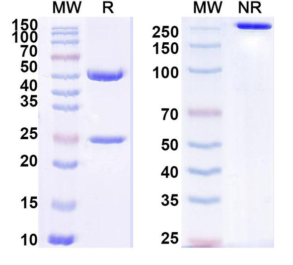Anti-Staphylococcus aureus nuc/Thermonuclease Recombinant Monoclonal Antibody (SAA1455) - SDS-PAGE