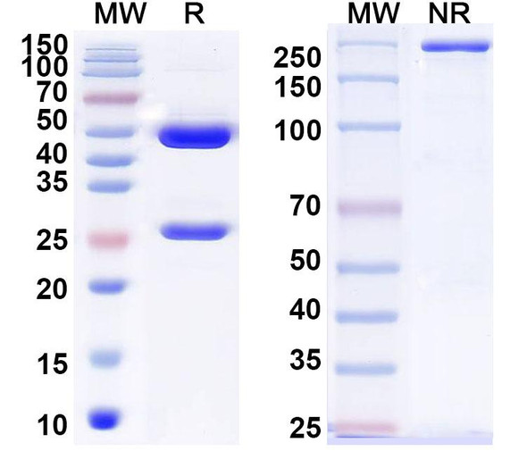 Anti-Coxsackievirus A16 Mature Virion/VP1, 2, 3 Recombinant Monoclonal Antibody (9D7) - SDS-PAGE