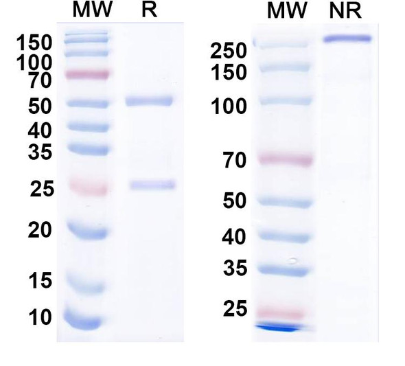 Anti-Vaccinia L1R/Protein L1 Recombinant Monoclonal Antibody (7D11) - SDS-PAGE