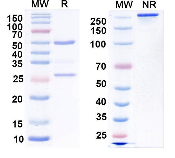 Anti-Vaccinia L1R/Protein L1 Recombinant Monoclonal Antibody (M12B9) - SDS-PAGE
