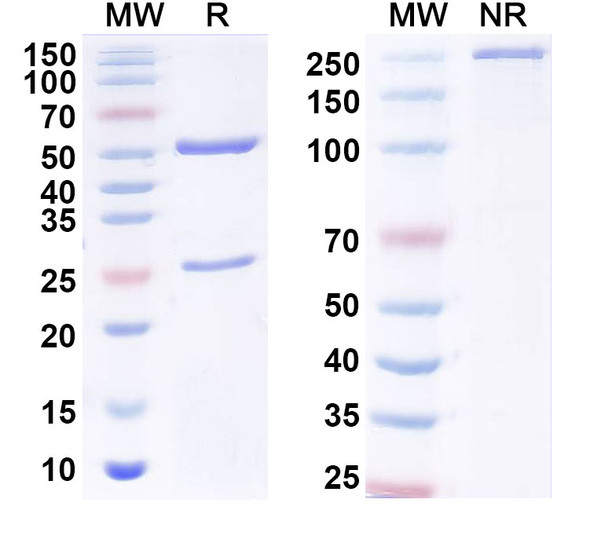 Anti-Human hCG/CGB Recombinant Monoclonal Antibody (3A2) - SDS-PAGE