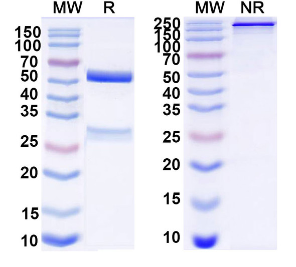 Anti-Bovine CD230/PRNP Recombinant Monoclonal Antibody (SAA2061) - SDS-PAGE