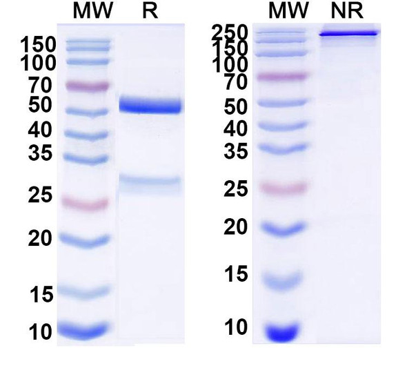 Anti-Bovine CD230/PRNP Recombinant Monoclonal Antibody (SAA2061) - SDS-PAGE