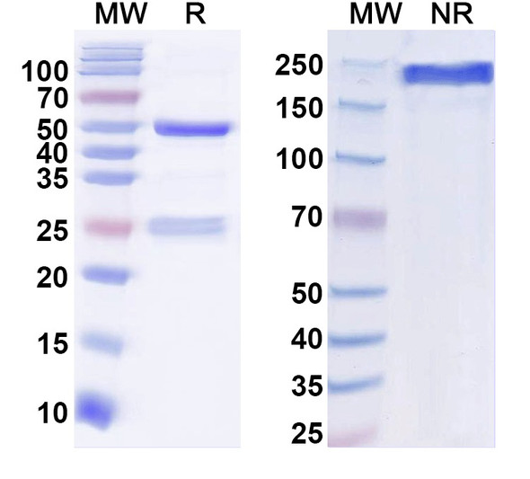 Anti-JEV Envelope protein E Recombinant Monoclonal Antibody (12B02) - SDS-PAGE