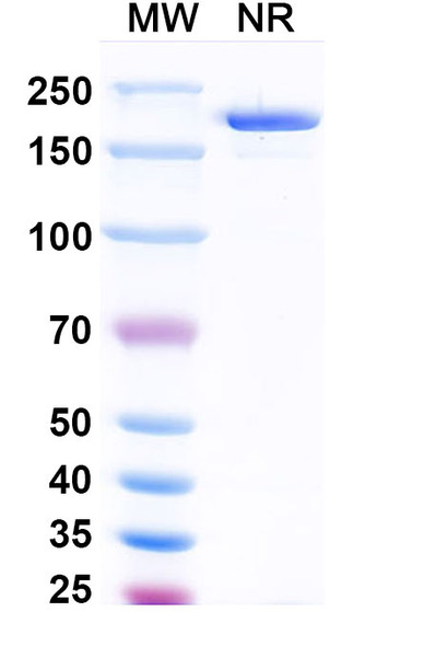 Anti-Human FSHB Recombinant Monoclonal Antibody (SAA1474) - SDS-PAGE