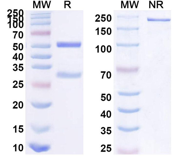 Anti-Human NLRP3 Recombinant Monoclonal Antibody (18#) - SDS-PAGE