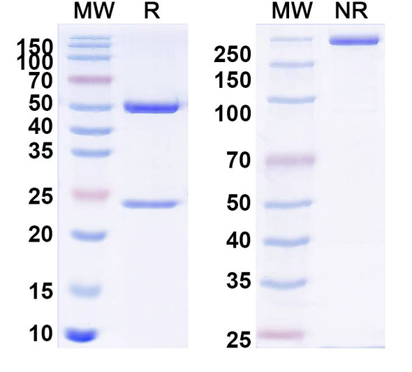 Anti-Human Osteocalcin/BGP/OC Recombinant Monoclonal Antibody (KTM219) - SDS-PAGE