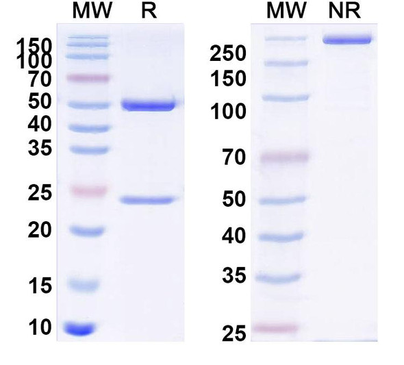 Anti-Human Osteocalcin/BGP/OC Recombinant Monoclonal Antibody (KTM219) - SDS-PAGE
