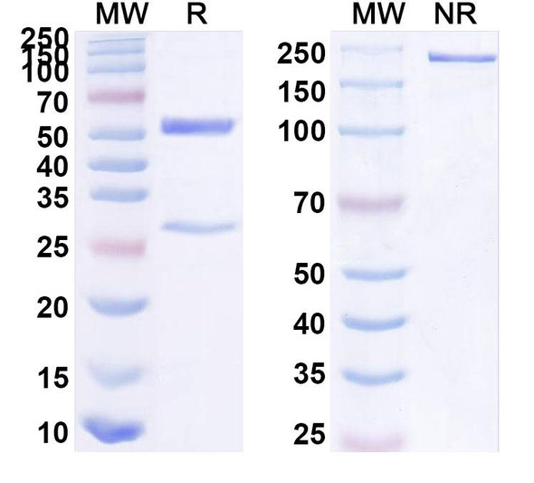 Anti-Human FABP4/aP2 Recombinant Monoclonal Antibody (SAA1478) - SDS-PAGE