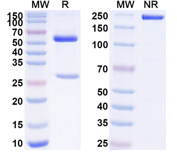 Anti-Human Hemoglobin Recombinant Monoclonal Antibody (HB-5) - SDS-PAGE