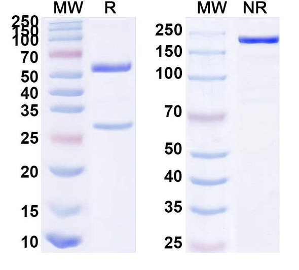 Anti-HHV-5/HCMV UL130 Recombinant Monoclonal Antibody (8I21#) - SDS-PAGE