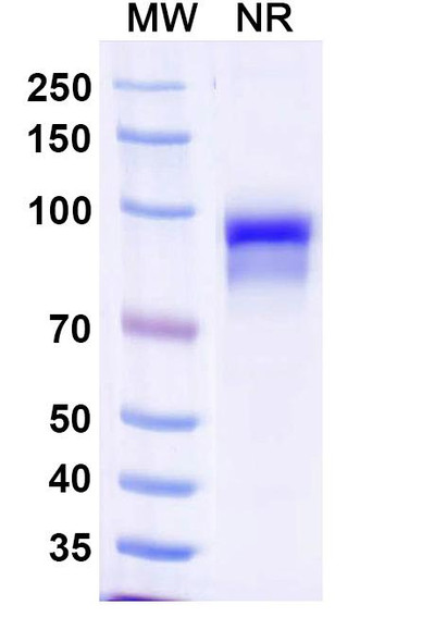 Anti-Human CFP/Properdin Recombinant Monoclonal Antibody (SAA1485) - SDS-PAGE