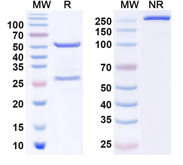 Anti-EBV/HHV4 gB/BALF4 Recombinant Monoclonal Antibody (1D8) - SDS-PAGE