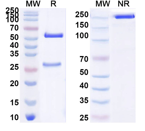 Anti-ZEBOV VP40/Matrix protein VP40 Recombinant Monoclonal Antibody (DSTL094) - SDS-PAGE