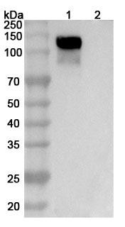 Anti-Human ROBO1 Recombinant Monoclonal Antibody (SAA1494) - WB