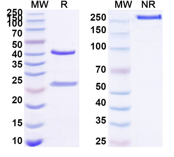 Anti-Human EREG/Epiregulin Recombinant Monoclonal Antibody (SAA1501) - SDS-PAGE