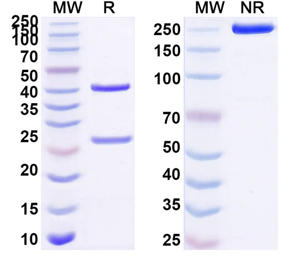 Anti-Human CD327/SIGLEC6 Recombinant Monoclonal Antibody (SAA1503) - SDS-PAGE