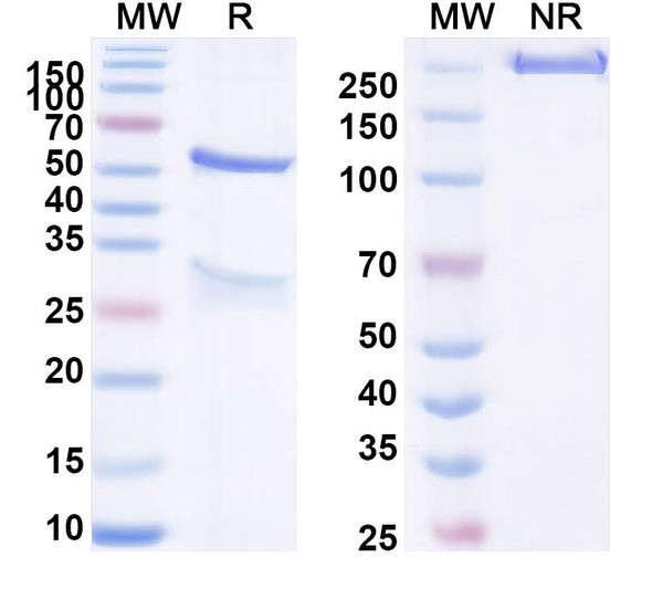 Anti-Human CLDN3 Recombinant Monoclonal Antibody (SAA1510) - SDS-PAGE