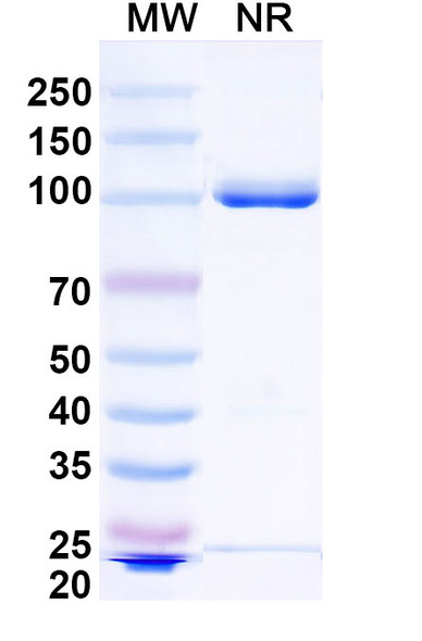 Anti-Human ADAM12 Recombinant Monoclonal Antibody (SAA1511) - SDS-PAGE