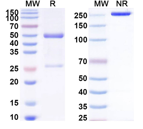 Anti-Human BUB1B Recombinant Monoclonal Antibody (SAA1518) - SDS-PAGE