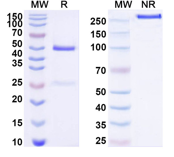 Anti-Human TSPAN3 Recombinant Monoclonal Antibody (SAA1519) - SDS-PAGE