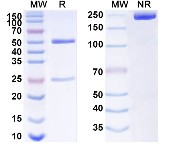 Anti-Human FZD7 Recombinant Monoclonal Antibody (SAA1525) - SDS-PAGE