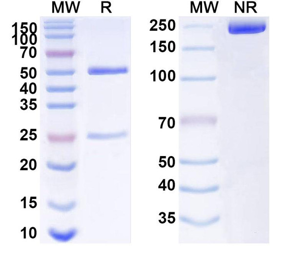 Anti-Human FZD7 Recombinant Monoclonal Antibody (SAA1525) - SDS-PAGE