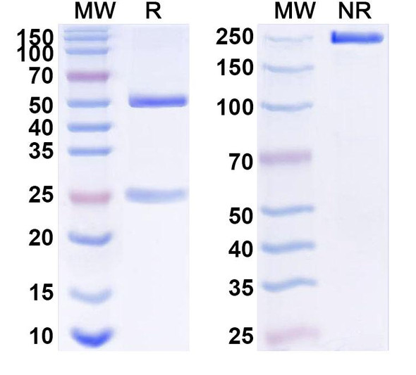 Anti-Human GPC4 Recombinant Monoclonal Antibody (SAA1528) - SDS-PAGE