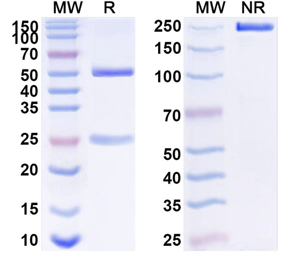 Anti-Human PGLYRP1 Recombinant Monoclonal Antibody (SAA1529) - SDS-PAGE